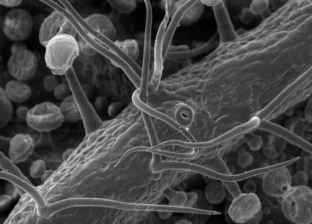 Electron microscopy photo of the hairs on a black walnut (Juglans nigra) leaf